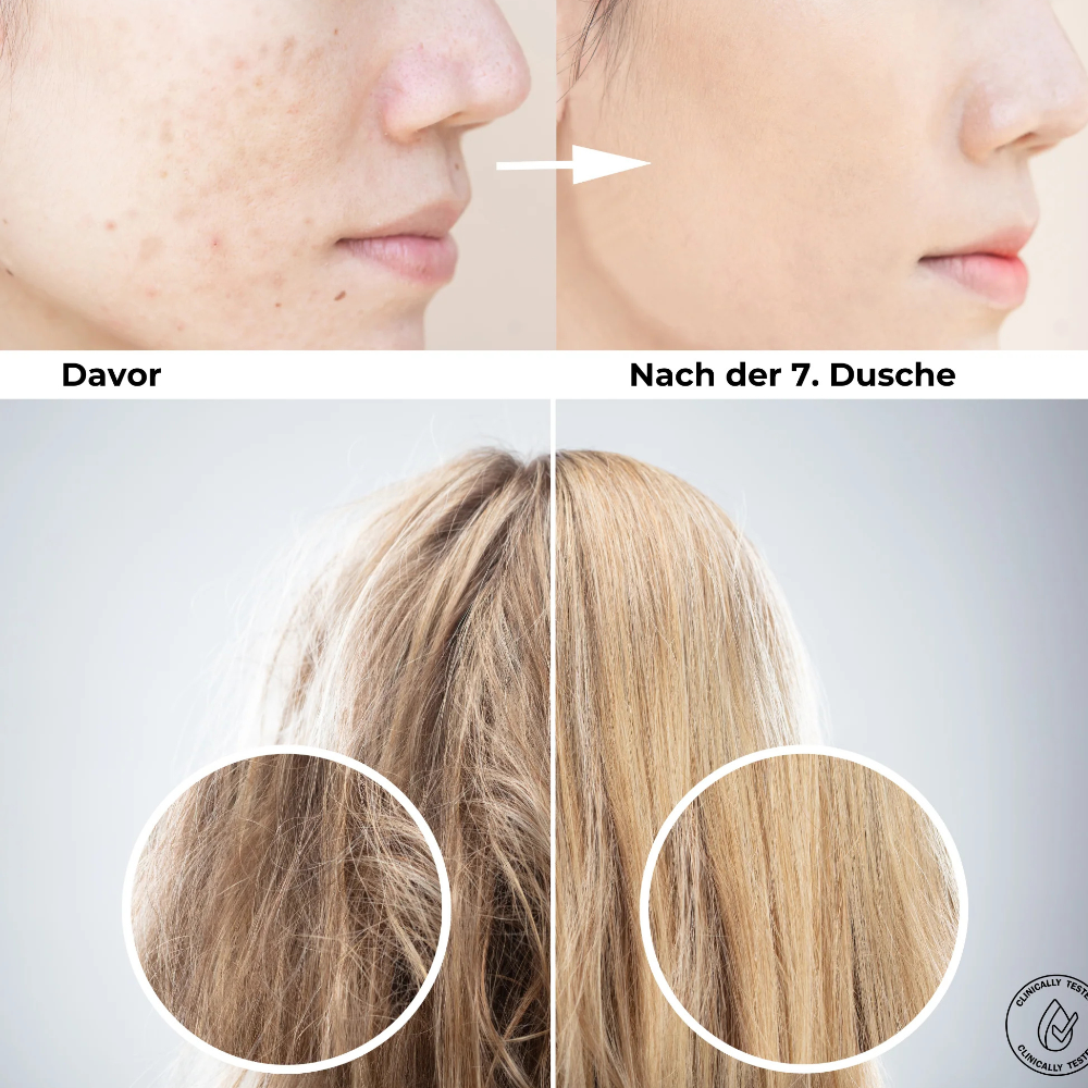 VitaDuschkopf  Filterset 5 St